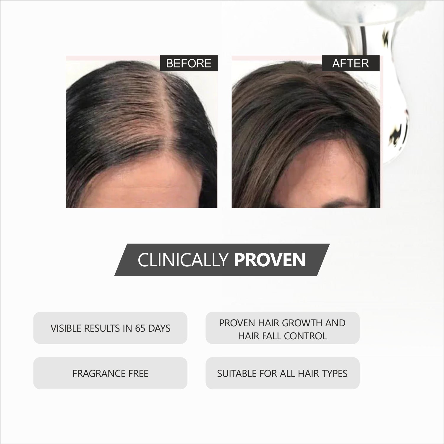 Lord's Redensyl & Anagain Hair Growth Serum (30 ml)